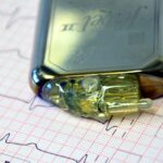 Pacemaker